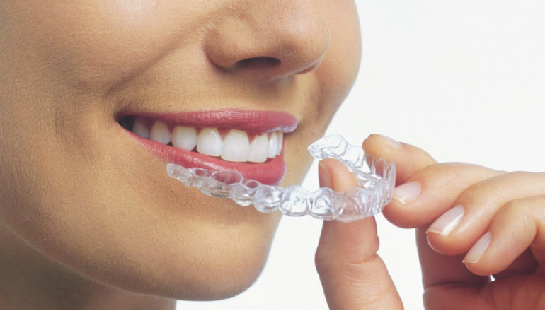 woman undergoing clear aligner therapy