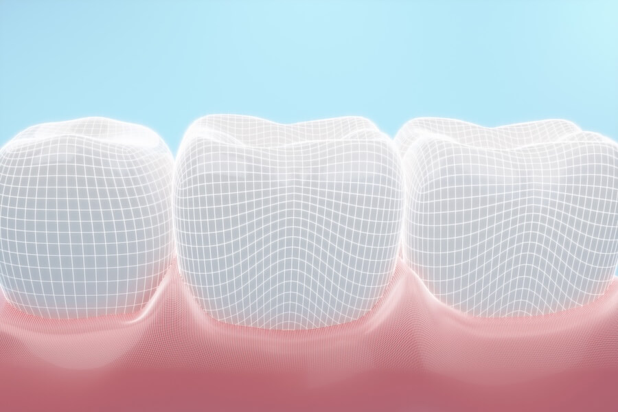 enamel erosion